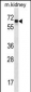 ANGPT2 Antibody (C-term)